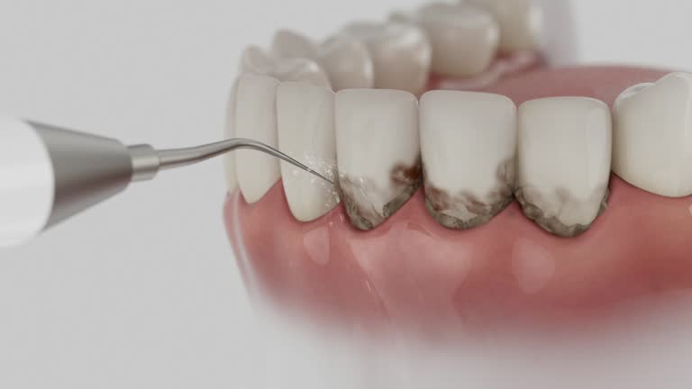 Trusted Teeth Cleaning And Checkup service in Bayou Gauche, LA - Dentist Open Now